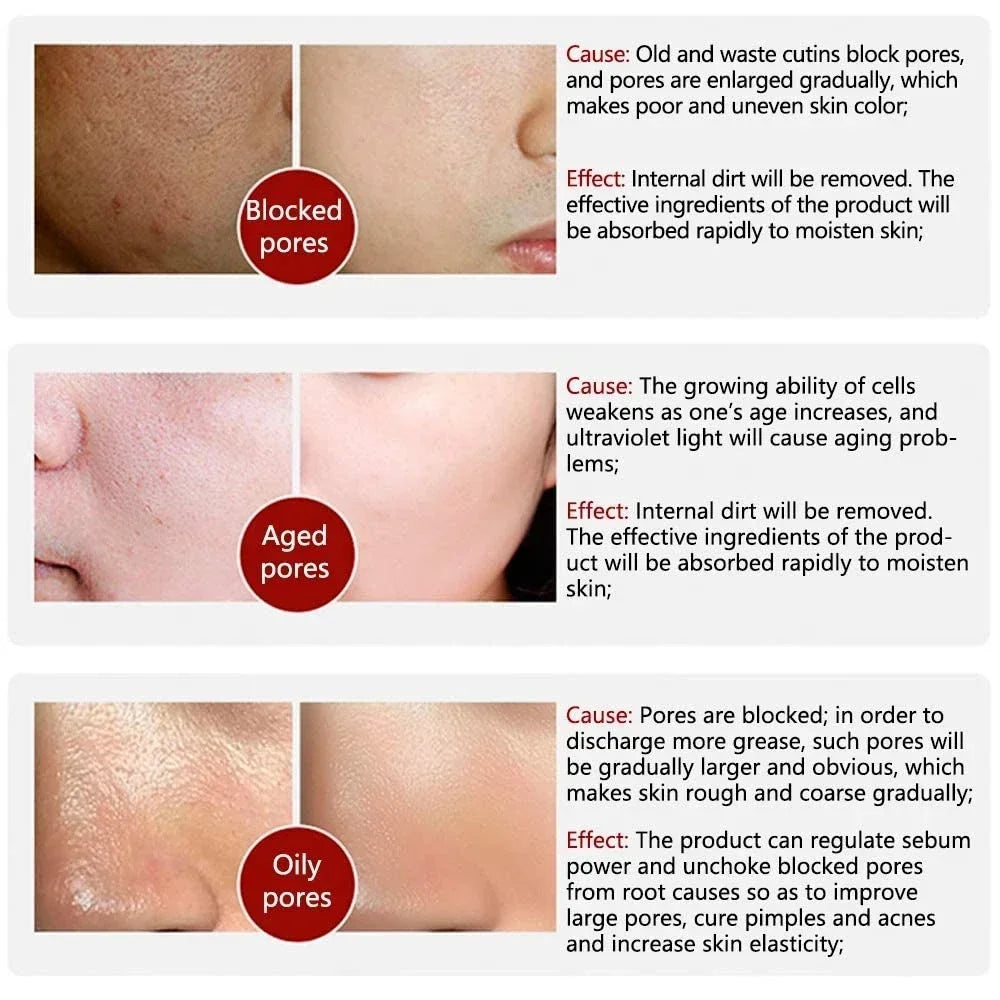 Clarté Pore Refining Serum