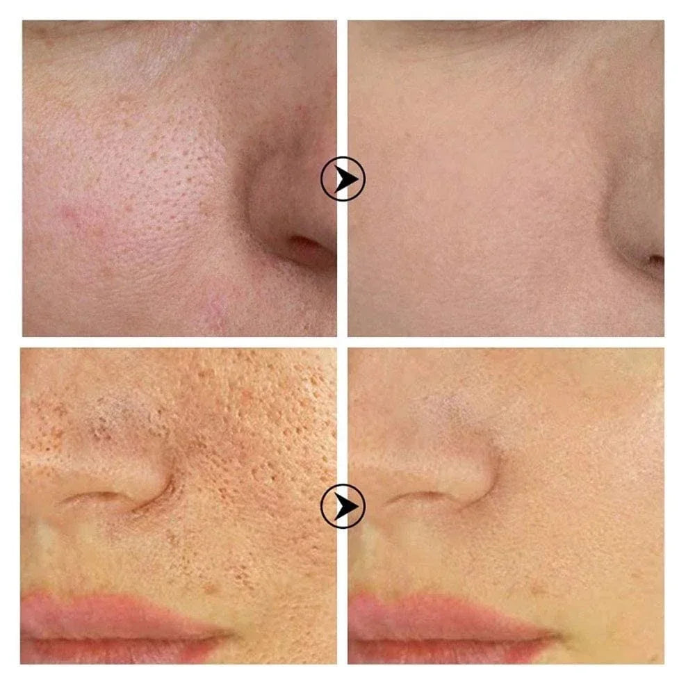 Clarté Pore Refining Serum