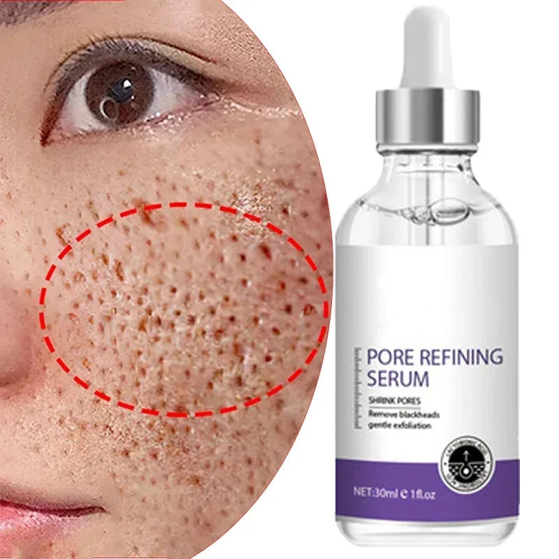 Clarté Pore Refining Serum