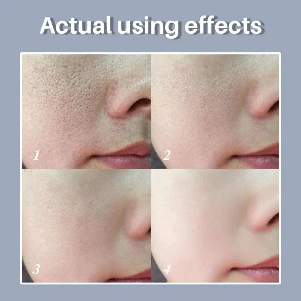 Clarté Pore Refining Serum